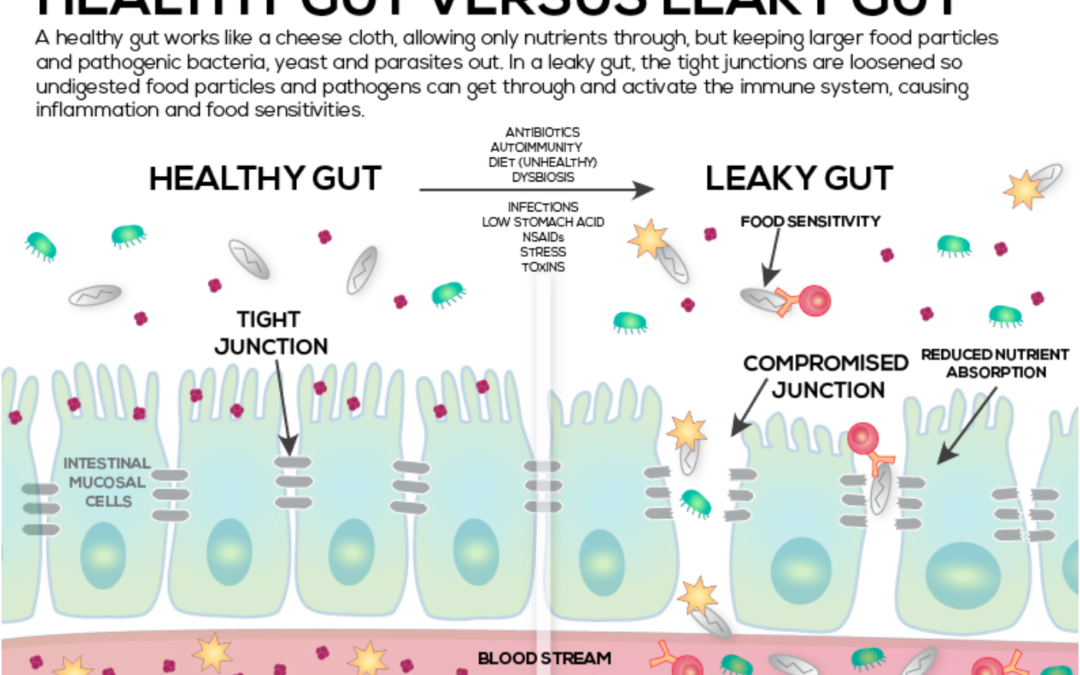 Understanding leaky gut, the microbiome, and why probiotics help.